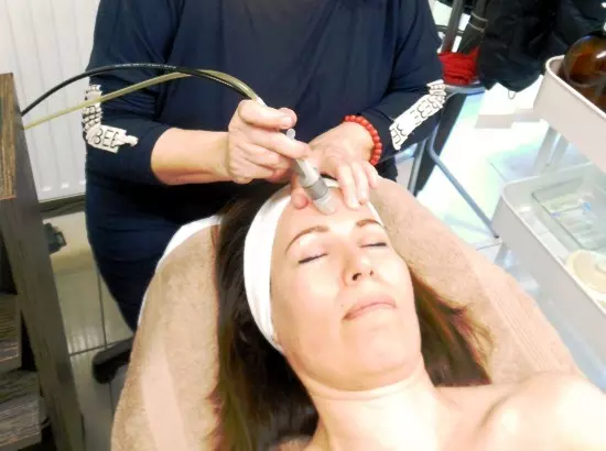 mikrodermabrázió kezelés mikrodermabrázió kezelés